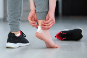 prevention and treatment of blisters for runners